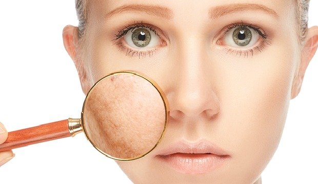 Pigmentation All You Need To Know About Diagnosis And Treatment