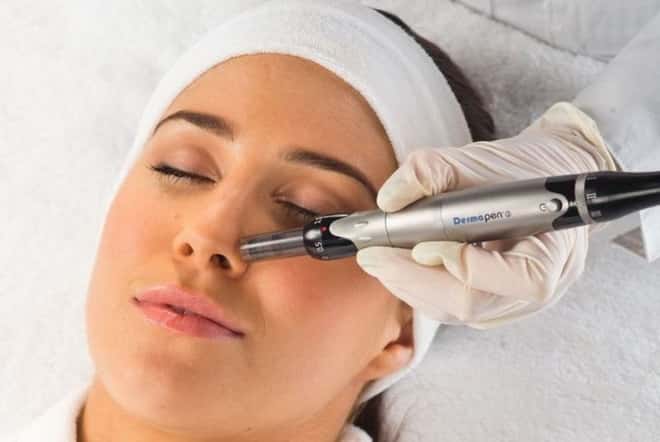 Mesotherapy VS Dermapen skin needling Whats the difference