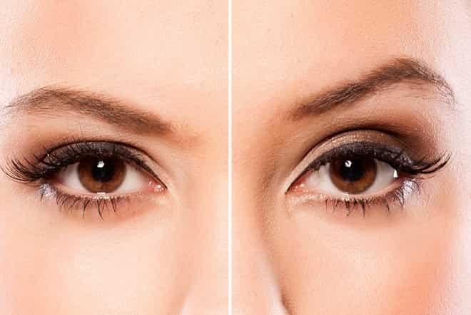 Brow Lift: How to create "brow wow" the non-surgical way