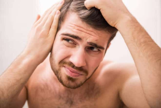 Why Men Go Bald - And Smart Solutions for Hair Loss