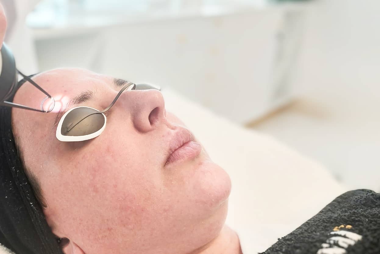 Layered Laser: Make Winter The Time For Deeper Treatment 