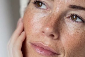 Injectables: Are You Team Biorevitalisation Or Bioregeneration?