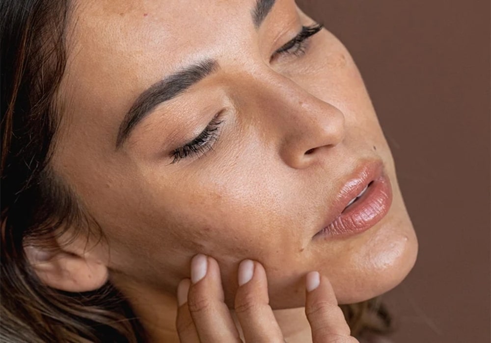 Melasma and the Basement Membrane: What's The Secret?